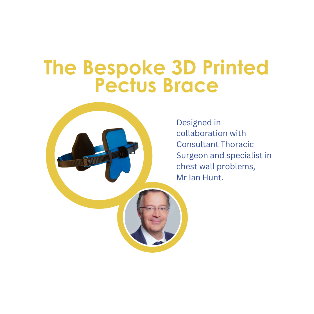 Crispin Unveils Cutting-Edge 3D Pectus Brace in Collaboration With Renowned Surgeon Mr Ian Hunt